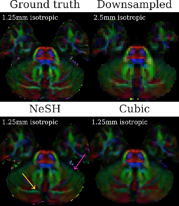 Figure 4 for Neural Spherical Harmonics for structurally coherent continuous representation of diffusion MRI signal