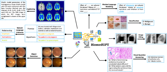 Figure 1 for BiomedGPT: A Unified and Generalist Biomedical Generative Pre-trained Transformer for Vision, Language, and Multimodal Tasks