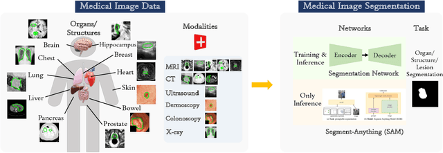 Figure 1 for Accuracy of Segment-Anything Model (SAM) in medical image segmentation tasks