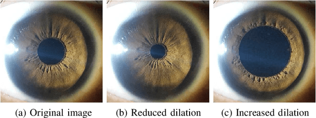 Figure 1 for Artificial Pupil Dilation for Data Augmentation in Iris Semantic Segmentation