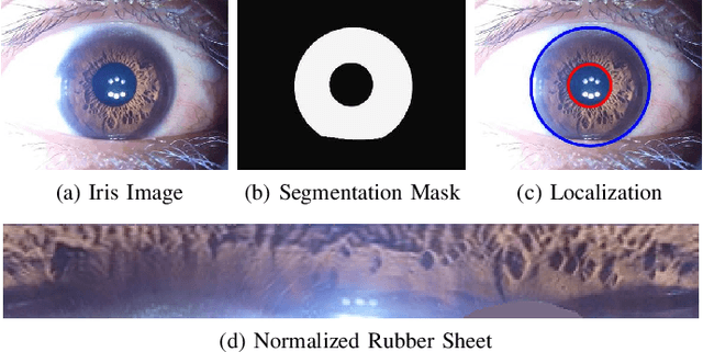 Figure 2 for Artificial Pupil Dilation for Data Augmentation in Iris Semantic Segmentation