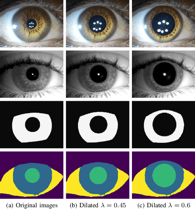 Figure 4 for Artificial Pupil Dilation for Data Augmentation in Iris Semantic Segmentation