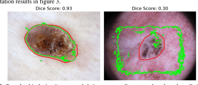 Figure 4 for SkinSAM: Empowering Skin Cancer Segmentation with Segment Anything Model