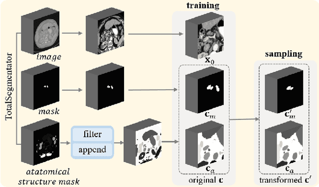 Figure 3 for CT Synthesis with Conditional Diffusion Models for Abdominal Lymph Node Segmentation