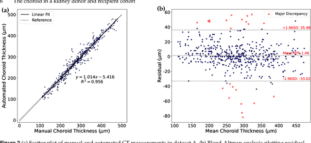 Figure 4 for Evaluation of an automated choroid segmentation algorithm in a longitudinal kidney donor and recipient cohort