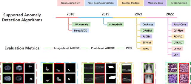 Figure 1 for BMAD: Benchmarks for Medical Anomaly Detection