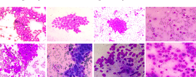 Figure 3 for Could We Generate Cytology Images from Histopathology Images? An Empirical Study