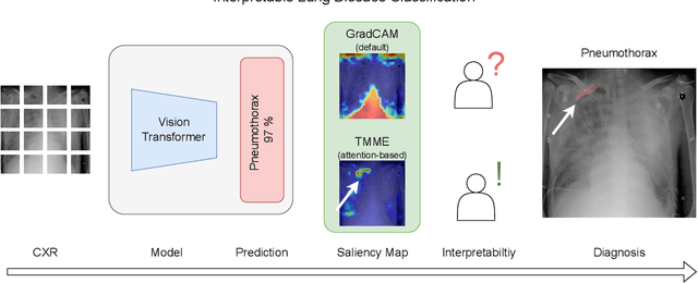 Figure 2 for Attention-based Saliency Maps Improve Interpretability of Pneumothorax Classification
