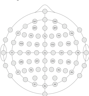 Figure 2 for Assessing gender fairness in EEG-based machine learning detection of Parkinson's disease: A multi-center study