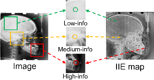 Figure 1 for Information-guided pixel augmentation for pixel-wise contrastive learning