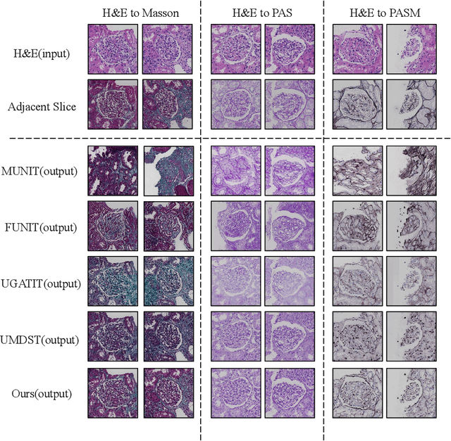 Figure 4 for AGMDT: Virtual Staining of Renal Histology Images with Adjacency-Guided Multi-Domain Transfer