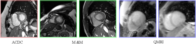 Figure 4 for Bayesian Uncertainty Estimation by Hamiltonian Monte Carlo: Applications to Cardiac MRI Segmentation