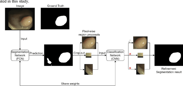 Figure 1 for Rethinking the transfer learning for FCN based polyp segmentation in colonoscopy