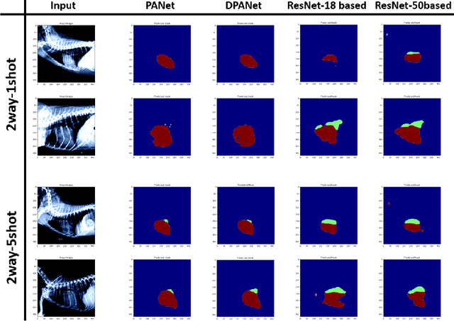 Figure 4 for Toward Robust Canine Cardiac Diagnosis: Deep Prototype Alignment Network-Based Few-Shot Segmentation in Veterinary Medicine