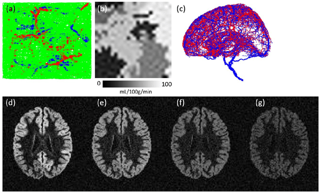 Figure 2 for Multi-delay arterial spin-labeled perfusion estimation with biophysics simulation and deep learning