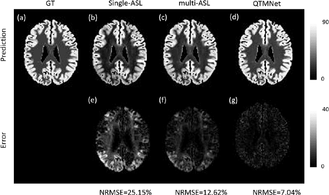 Figure 3 for Multi-delay arterial spin-labeled perfusion estimation with biophysics simulation and deep learning