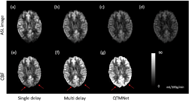 Figure 4 for Multi-delay arterial spin-labeled perfusion estimation with biophysics simulation and deep learning