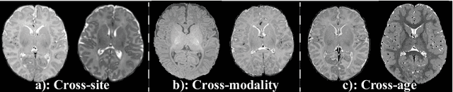 Figure 1 for 3D Masked Autoencoding and Pseudo-labeling for Domain Adaptive Segmentation of Heterogeneous Infant Brain MRI