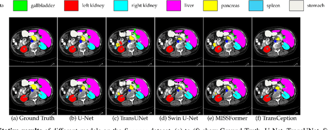 Figure 4 for Enhancing Medical Image Segmentation with TransCeption: A Multi-Scale Feature Fusion Approach