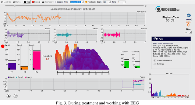 Figure 2 for A Survey on the Role of Artificial Intelligence in the Prediction and Diagnosis of Schizophrenia