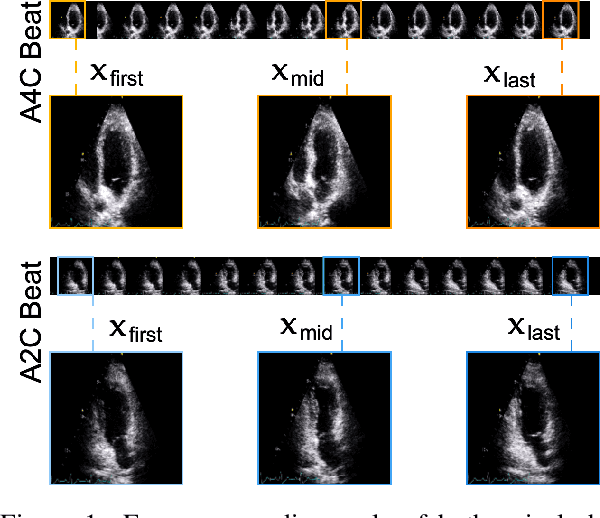 Figure 1 for SAF-Net: Self-Attention Fusion Network for Myocardial Infarction Detection using Multi-View Echocardiography