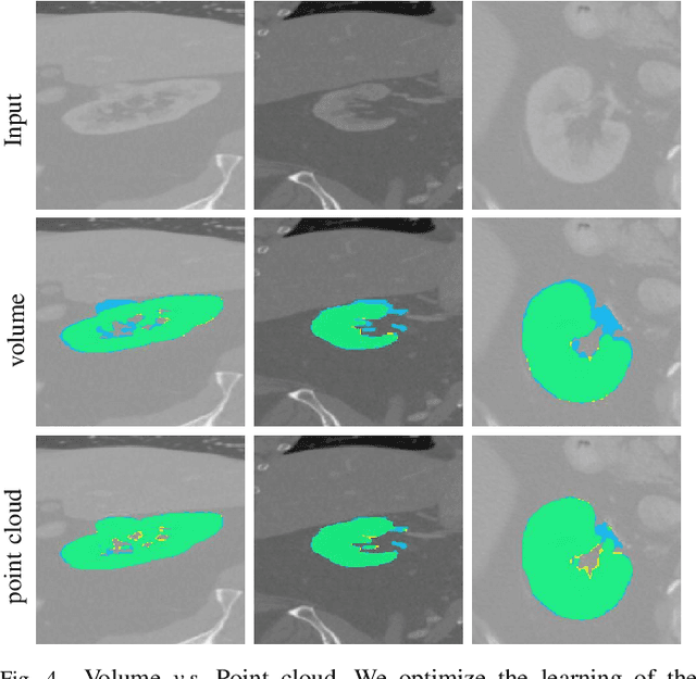 Figure 4 for Weakly-Supervised 3D Medical Image Segmentation using Geometric Prior and Contrastive Similarity