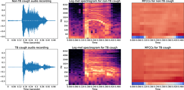 Figure 4 for Predicting Tuberculosis from Real-World Cough Audio Recordings and Metadata
