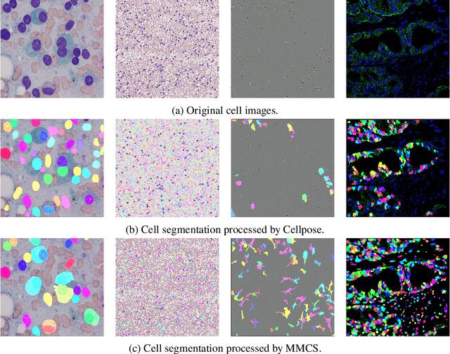 Figure 3 for Advanced Multi-Microscopic Views Cell Semi-supervised Segmentation