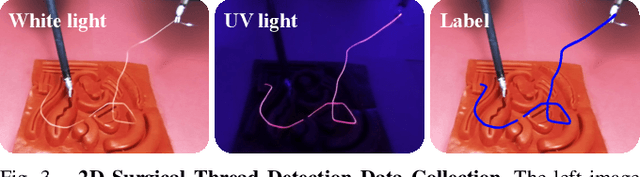 Figure 3 for Self-Supervised Learning for Interactive Perception of Surgical Thread for Autonomous Suture Tail-Shortening