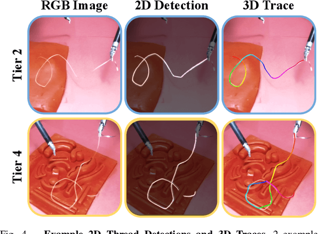 Figure 4 for Self-Supervised Learning for Interactive Perception of Surgical Thread for Autonomous Suture Tail-Shortening