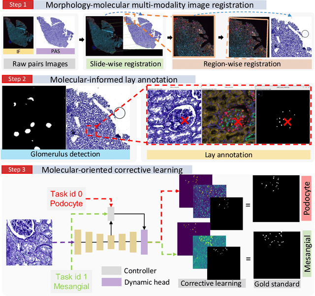 Figure 3 for Democratizing Pathological Image Segmentation with Lay Annotators via Molecular-empowered Learning
