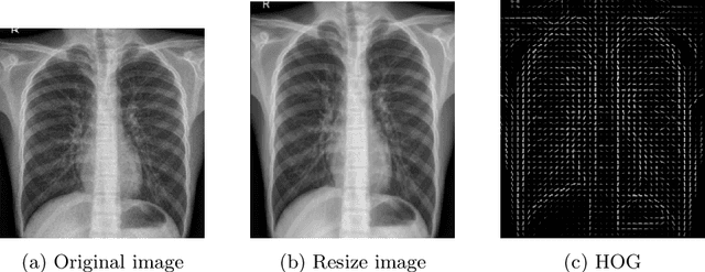 Figure 3 for Deep learning methods for automatic classification of medical images and disease detection based on chest X-Ray images