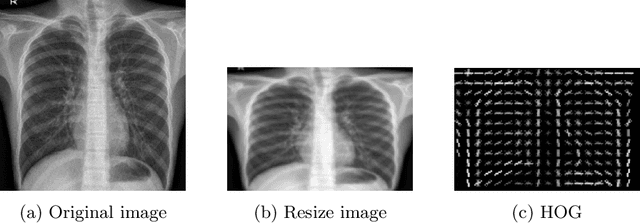 Figure 4 for Deep learning methods for automatic classification of medical images and disease detection based on chest X-Ray images