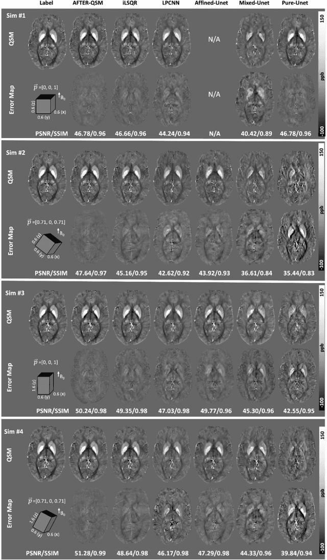 Figure 3 for Affine Transformation Edited and Refined Deep Neural Network for Quantitative Susceptibility Mapping