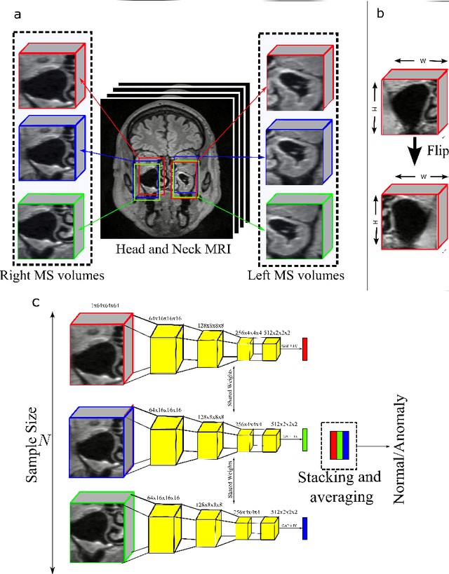 Figure 1 for Multiple Instance Ensembling For Paranasal Anomaly Classification In The Maxillary Sinus