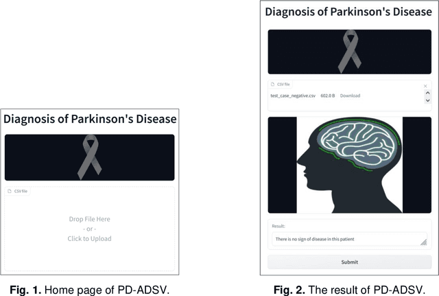 Figure 1 for PD-ADSV: An Automated Diagnosing System Using Voice Signals and Hard Voting Ensemble Method for Parkinson's Disease
