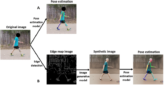 Figure 1 for Diffusion Models Enable Zero-Shot Pose Estimation for Lower-Limb Prosthetic Users