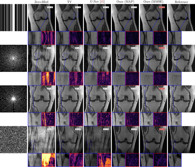 Figure 1 for Stable deep MRI reconstruction using Generative Priors
