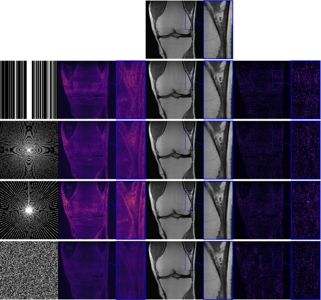 Figure 3 for Stable deep MRI reconstruction using Generative Priors