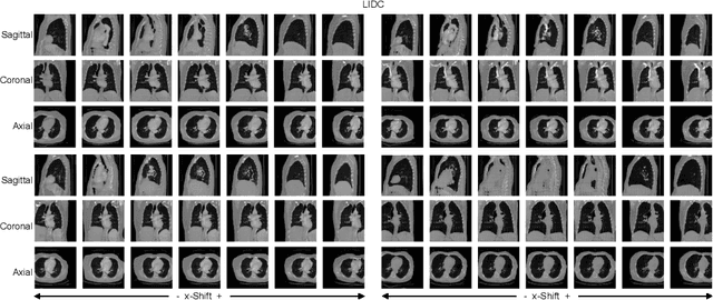 Figure 3 for Explicit Temporal Embedding in Deep Generative Latent Models for Longitudinal Medical Image Synthesis