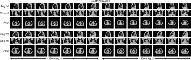 Figure 4 for Explicit Temporal Embedding in Deep Generative Latent Models for Longitudinal Medical Image Synthesis