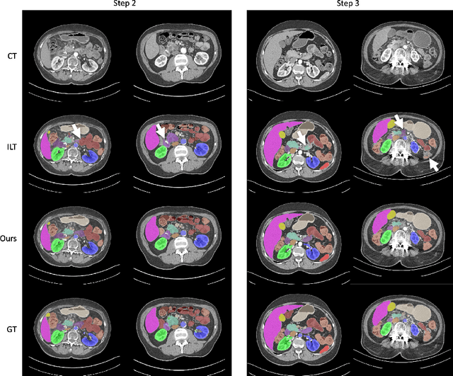Figure 4 for Continual Learning for Abdominal Multi-Organ and Tumor Segmentation