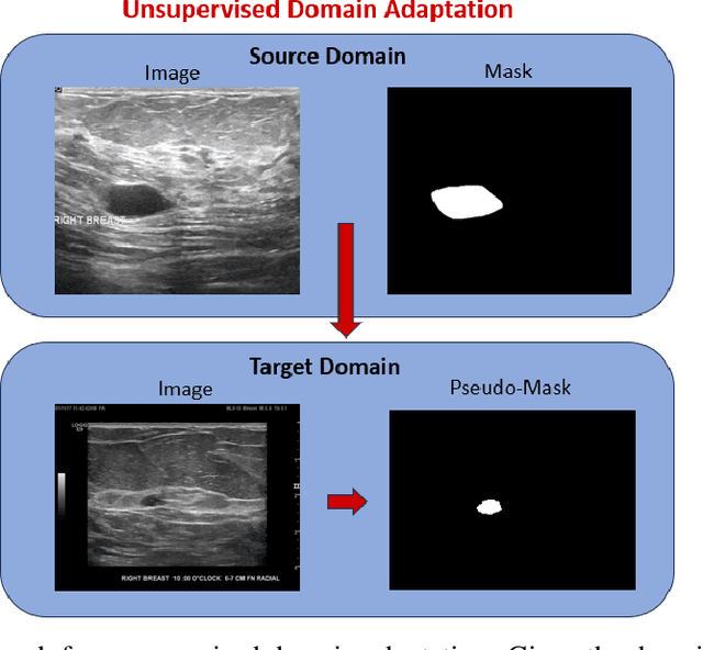 Figure 2 for Enhancing AI Diagnostics: Autonomous Lesion Masking via Semi-Supervised Deep Learning