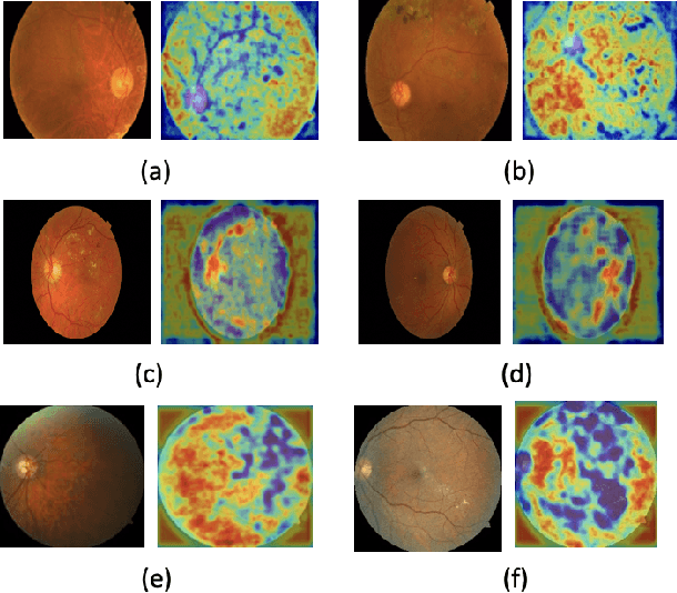 Figure 3 for Learning Self-Supervised Representations for Label Efficient Cross-Domain Knowledge Transfer on Diabetic Retinopathy Fundus Images