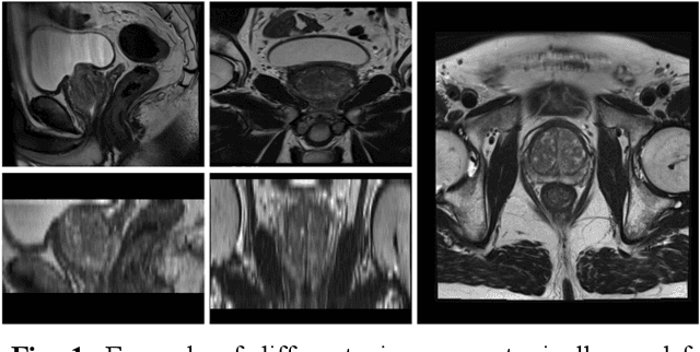 Figure 1 for Leveraging multi-view data without annotations for prostate MRI segmentation: A contrastive approach