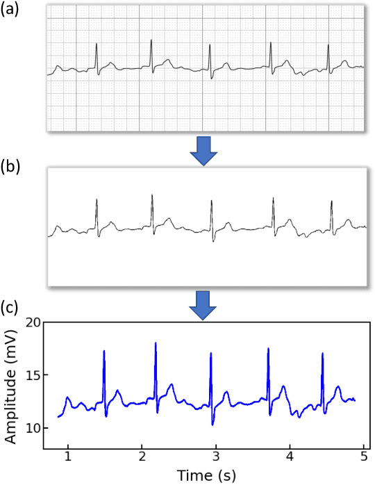 Figure 1 for Automated Identication of Atrial Fibrillation from Single-lead ECGs Using Multi-branching ResNet