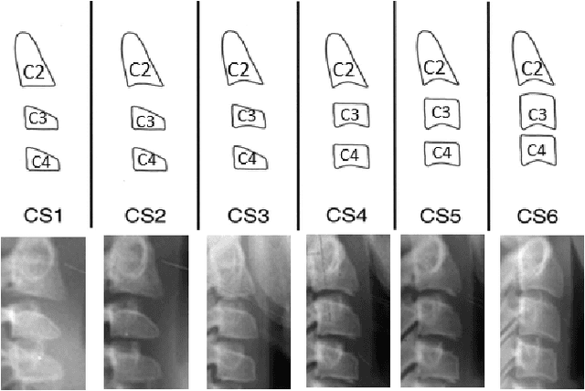 Figure 3 for Classification of the Cervical Vertebrae Maturation (CVM) stages Using the Tripod Network