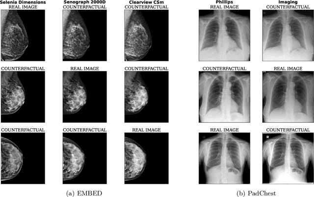 Figure 2 for Counterfactual contrastive learning: robust representations via causal image synthesis