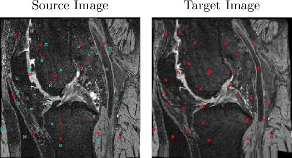 Figure 1 for Self-supervised Landmark Learning with Deformation Reconstruction and Cross-subject Consistency Objectives