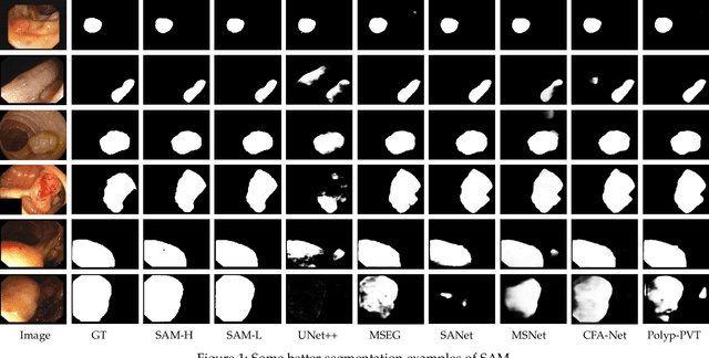 Figure 2 for Can SAM Segment Polyps?